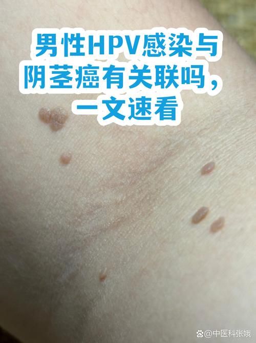 专家:介休每年或现多个感染高峰/介休有新型病毒感染的吗