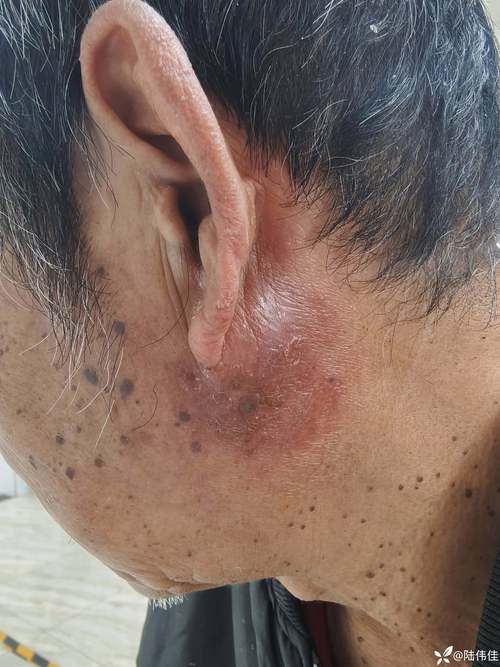 灵璧县新增19例无症状感染者及6例无症状:灵璧县疫情