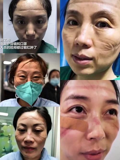 盱眙县最新疫情_盱眙县有没有新型冠状病毒